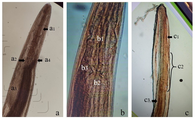 Diferenciación morfológica de los géneros de anisákidos identificados en las especies C. guatucupa y M. ancylodon, por la técnica de aclaración con lactofenol y visualización al microscopio. a. Género Contracaecum recuperado de cavidad celómica de M. ancylodon: esófago (a1), ventrículo (a2), apéndice ventricular (a3), ciego intestinal (a4) / b. Género Pseudoterranova recuperado de músculo de C. guatucupa: esófago (b1), ventrículo (b2), ciego intestinal (b3) / c. Género Anisakis recuperado de músculo de C. guatucupa: esófago (c1), ventrículo (c2), intestino (c3).