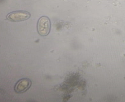 Fragmento de fotografía de vermes de entre 3,5 y 4,5 cm que fueron obtenidos del vómito de un paciente felino, común europeo, hembra, de 5 años de edad, con historial de gastritis crónica.