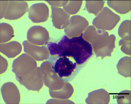 Imágenes de células de Kurloff obtenidas a partir de extendidos de sangre de carpinchos (Hydrochoerus hydrochaeris) de una población silvestre de los Esteros del Iberá, Corrientes, Argentina.